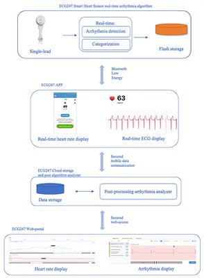 Heart rhythm assessment in elite endurance athletes: A better method?